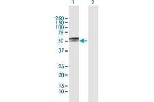 Western Blot analysis of PAX3 expression in transfected 293T cell line by PAX3 MaxPab polyclonal antibody. (Paired Box 3 anticorps  (AA 1-484))
