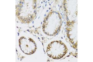 Immunohistochemistry of paraffin-embedded human stomach using ATP1A1 antibody (ABIN5970238) at dilution of 1/100 (40x lens). (ATP1A1 anticorps)