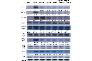 Western Blotting (WB) image for anti-Signal Transducer and Activator of Transcription 3 (Acute-Phase Response Factor) (STAT3) (C-Term) antibody (ABIN2855865)