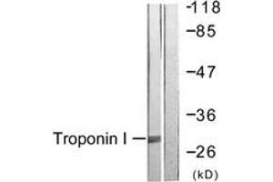 Western blot analysis of extracts from Jurkat cells, using TNNI3 (Ab-43) Antibody. (TNNI3 anticorps  (AA 11-60))