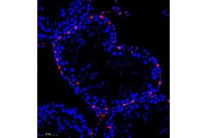 Immunofluorescence of paraffin embedded rat testis using kb12 (ABIN7075406) at dilution of 1:700 (260x lens) (p130 anticorps)