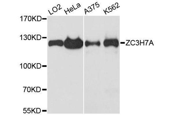 ZC3H7A anticorps  (AA 1-220)
