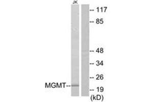Western Blotting (WB) image for anti-O6-Methylguanine-DNA-Methyltransferase (MGMT) (AA 1-50) antibody (ABIN2890010) (MGMT anticorps  (AA 1-50))