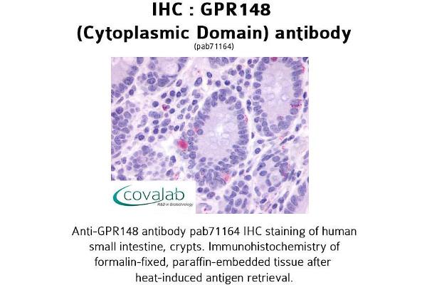 GPR148 anticorps  (3rd Cytoplasmic Domain)