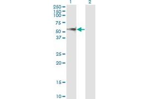 Western Blot analysis of PPM1F expression in transfected 293T cell line by PPM1F monoclonal antibody (M02), clone 1G10. (PPM1F anticorps  (AA 1-100))