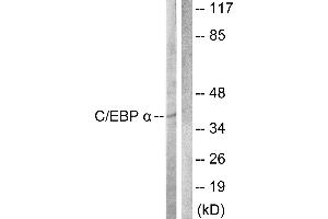 Western blot analysis of extracts from COS7 cells, treated with EGF (200ng/ml, 30mins), using C/EBP-α (Ab-222) antibody. (CEBPA anticorps  (Thr222))