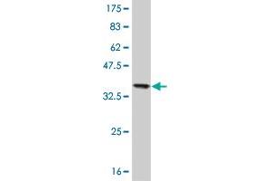 Western Blotting (WB) image for anti-Nucleoside diphosphate kinase B (NME2) (AA 51-152) antibody (ABIN518376)