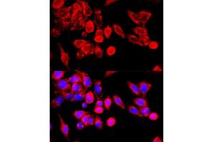 Immunofluorescence analysis of HeLa cells using TRPC6 antibody (ABIN7270918) at dilution of 1:100 (40x lens). (TRPC6 anticorps  (AA 732-931))
