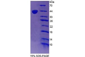 SDS-PAGE (SDS) image for Nuclear Receptor Subfamily 2, Group C, Member 1 (NR2C1) (AA 1-324) protein (His tag) (ABIN6239521) (NR2C1 Protein (AA 1-324) (His tag))