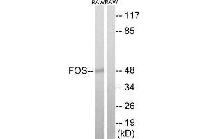 Western Blotting (WB) image for anti-c-Fos (c-Fos) (Thr232) antibody (ABIN1848286) (c-FOS anticorps  (Thr232))