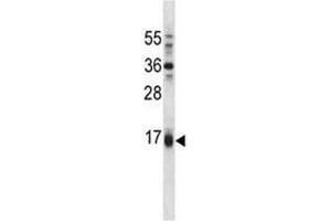 Puma antibody western blot analysis in A549 lysate. (PUMA anticorps  (AA 109-137))