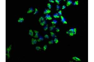 Immunofluorescence staining of Hela cells with ABIN7169031 at 1:100, counter-stained with DAPI. (PKC mu anticorps  (AA 674-904))