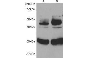 Western blot testing of rat aortic smooth muscle cells before (1) and after (2) infection with human APPL1 adenovirus for 48hrs. (APPL1 anticorps)
