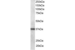 Western Blotting (WB) image for anti-PDZ and LIM Domain 1 (PDLIM1) (C-Term) antibody (ABIN2466090) (PDLIM1 anticorps  (C-Term))