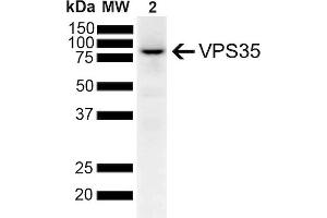 Western Blot analysis of Human SH-SY5Y lysates showing detection of 91. (VPS35 anticorps  (PE))
