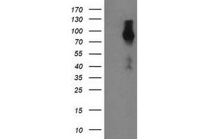 Western Blotting (WB) image for anti-Fibroblast Growth Factor Receptor 2 (FGFR2) antibody (ABIN1498252) (FGFR2 anticorps)