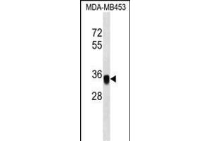 EpC Antibody (C-term) (ABIN1536832 and ABIN2849616) western blot analysis in MDA-M cell line lysates (35 μg/lane). (EpCAM anticorps  (C-Term))