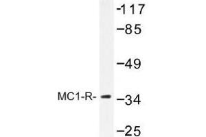 Image no. 1 for anti-Melanocortin 1 Receptor (MC1R) antibody (ABIN317707) (MC1 Receptor anticorps)