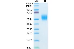 Mouse FGFR2 beta (IIIb) on Tris-Bis PAGE under reduced conditions. (FGFR2 beta (AA 39-263) protein (His tag))