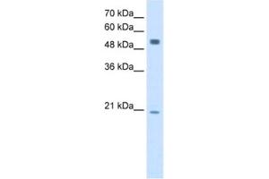 Western Blotting (WB) image for anti-B Lymphoid Tyrosine Kinase (BLK) antibody (ABIN2462928) (BLK anticorps)