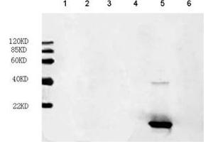 Primary antibody: 1 µg/mL FGF acidic Antibody, mAb, mouse (ABIN399028) Secondary antibody: IRDye800 Conjugated affinity purified anti-Mouse IgG [GOAT] (1: 10,000) Loading: Lane 1: hFGF-6 recombinant protein (200 ng) Lane 2: hFGF-16 recombinant protein (200 ng) Lane 3: hFGF-17 recombinant protein (200 ng) Lane 4: hFGF-18 recombinant protein (200 ng) Lane 5: FGF acidic recombinant protein (200 ng) Lane 6: FGF basic recombinant protein (200 ng) (FGF acidic anticorps)