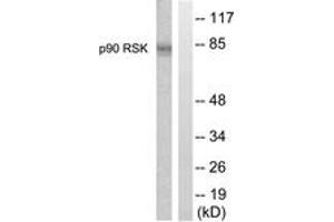 Western Blotting (WB) image for anti-Ribosomal Protein S6 Kinase, 90kDa, Polypeptide 1 (RPS6KA1) (AA 331-380) antibody (ABIN2888685) (RPS6KA1 anticorps  (AA 331-380))
