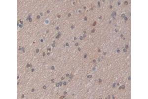 Used in DAB staining on fromalin fixed paraffin- embedded brain tissue (CABIN1 anticorps  (AA 23-288))