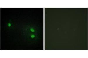 Immunofluorescence analysis of HeLa cells, using Histone H2B Antibody. (Histone H2B anticorps  (AA 1-50))