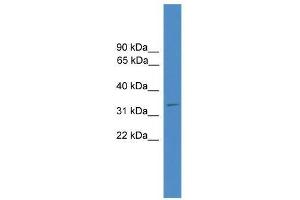 Ccnd1 antibody used at 0. (Cyclin D1 anticorps  (C-Term))