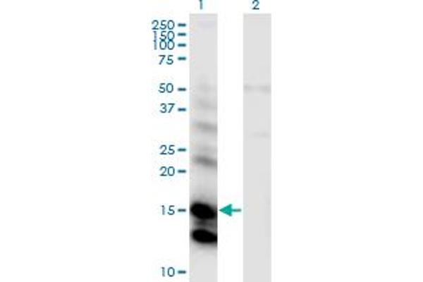 CST6 anticorps  (AA 29-149)