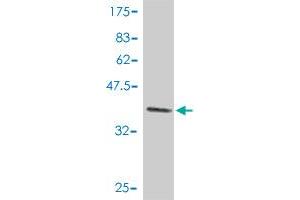 Western Blot detection against Immunogen (37. (p300 anticorps  (AA 731-830))