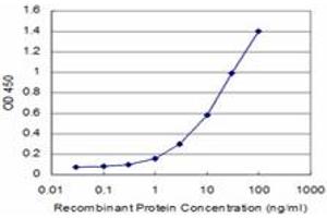 Detection limit for recombinant GST tagged CARF is approximately 1ng/ml as a capture antibody. (CDKN2AIP anticorps  (AA 1-579))