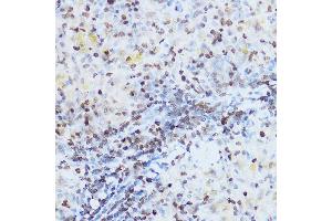 Immunohistochemistry of paraffin-embedded rat spleen using OGT Rabbit pAb (ABIN3022707, ABIN3022708, ABIN3022709 and ABIN6219152) at dilution of 1:100 (40x lens). (OGT anticorps  (AA 857-1036))