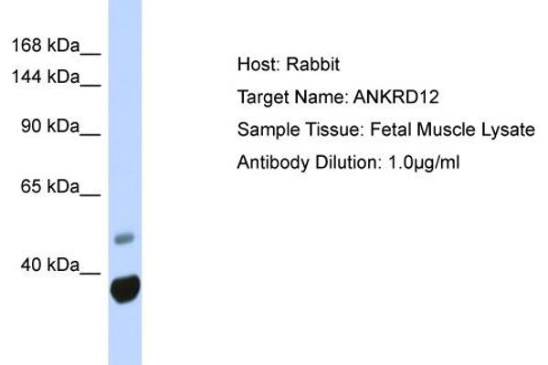 ANKRD12 anticorps  (N-Term)