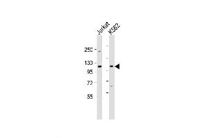 Western Blot at 1:1000 dilution Lane 1: Jurkat whole cell lysate Lane 2: K562 whole cell lysate Lysates/proteins at 20 ug per lane. (MTHFD1 anticorps  (AA 535-562))