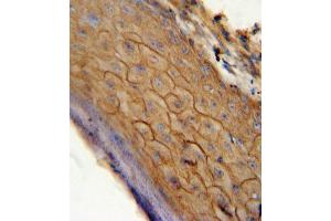 Immunohistochemistry (Paraffin-embedded Sections) (IHC (p)) image for anti-Cannabinoid Receptor 2 (CNR2) (AA 329-356), (C-Term) antibody (ABIN654631)