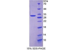 SDS-PAGE analysis of Mouse APP Protein. (APP Protéine)