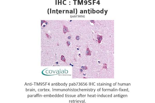 TM9SF4 anticorps  (Internal Region)