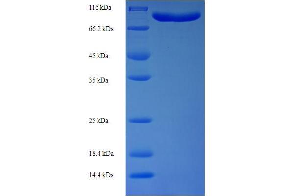 DNAJC10 Protein (AA 1-656, full length) (His-SUMO Tag)