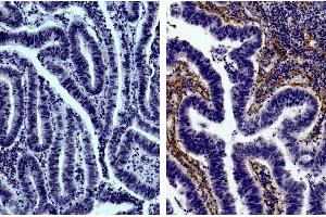 Immunohistochemistry (IHC) image for Pig anti-Goat IgG (Heavy & Light Chain) antibody (PE) - Preadsorbed (ABIN376549)
