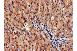 Immunohistochemistry of paraffin-embedded human liver tissue using ABIN7144005 at dilution of 1:100 (CD13 anticorps  (AA 34-219))