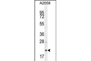 S1 Antibody (N-term) (ABIN654456 and ABIN2844190) western blot analysis in  cell line lysates (35 μg/lane). (AP3S1 anticorps  (N-Term))