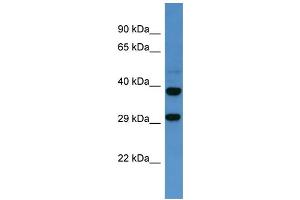 Western Blotting (WB) image for anti-Somatostatin Receptor 2 (SSTR2) (C-Term) antibody (ABIN2505939) (SSTR2 anticorps  (C-Term))