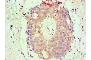 Immunohistochemical of paraffin-embedded Human endometrium tissue using ABIN7145293 at dilution of 1:200 (BCL2L1 anticorps)