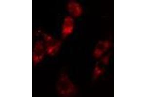 ABIN6279766 staining Hela cells by IF/ICC. (ARHGAP12 anticorps  (Internal Region))