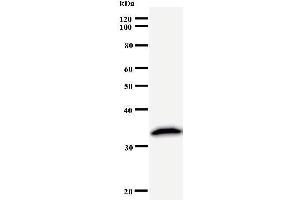 Western Blotting (WB) image for anti-PRP8 Pre-mRNA Processing Factor 8 (PRPF8) antibody (ABIN933118) (PRPF8 anticorps)