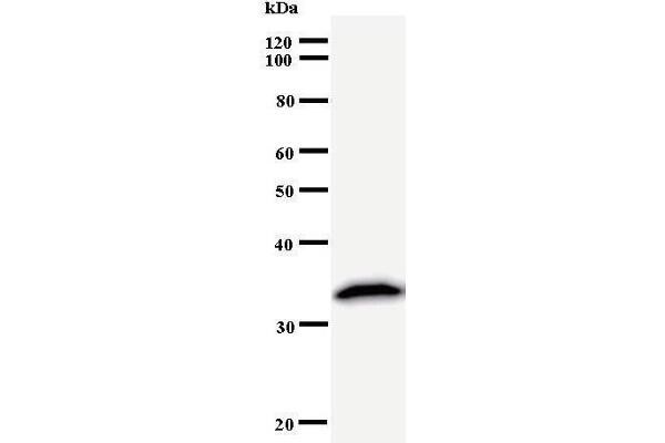 PRPF8 anticorps