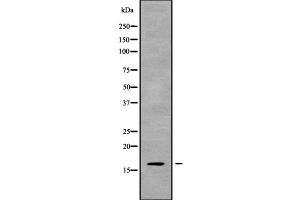 Western blot analysis of CST8 using Jurkat whole cell lysates (CST8 anticorps  (Internal Region))