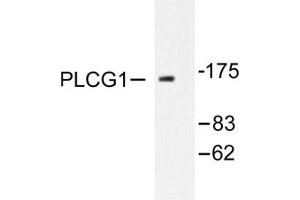 Image no. 2 for anti-phospholipase C, gamma 1 (PLCG1) antibody (ABIN271786) (Phospholipase C gamma 1 anticorps)