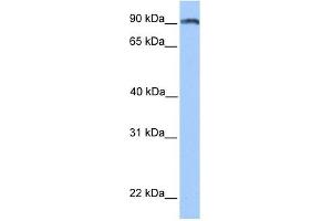 ANKS3 antibody used at 1 ug/ml to detect target protein. (ANKS3 anticorps  (N-Term))